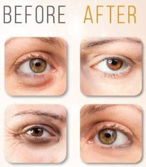 Eyeliss Serum_Reducing Eye Puffiness & Dark Circles